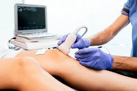 Ultrasound